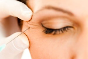 Botox Works for Forehead Lines, Too!
