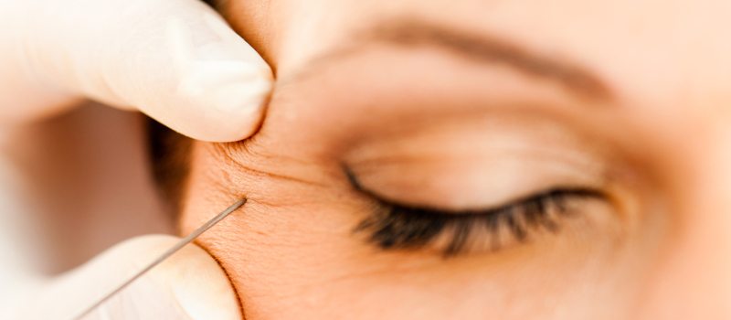 Botox Works for Forehead Lines, Too!