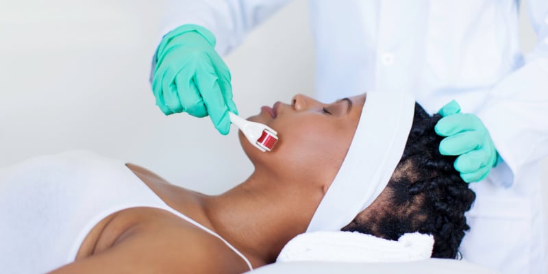 Micro-Needling