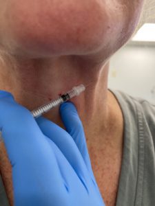 Platsymal Bands/Neck Creases