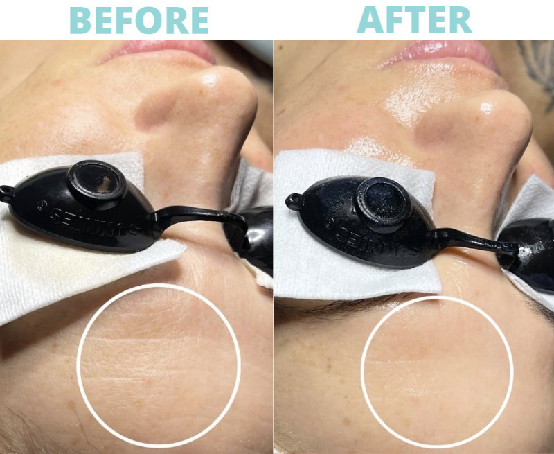 Ageless Signature Spa Facial_res OBAGI