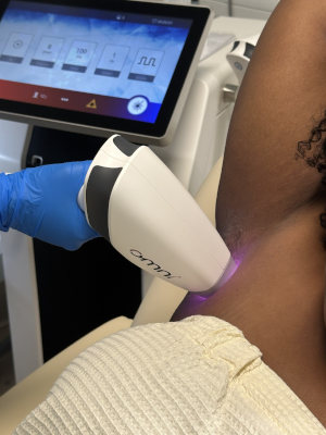 OMNI Permanent Hair Reduction in Kernersville, North Carolina