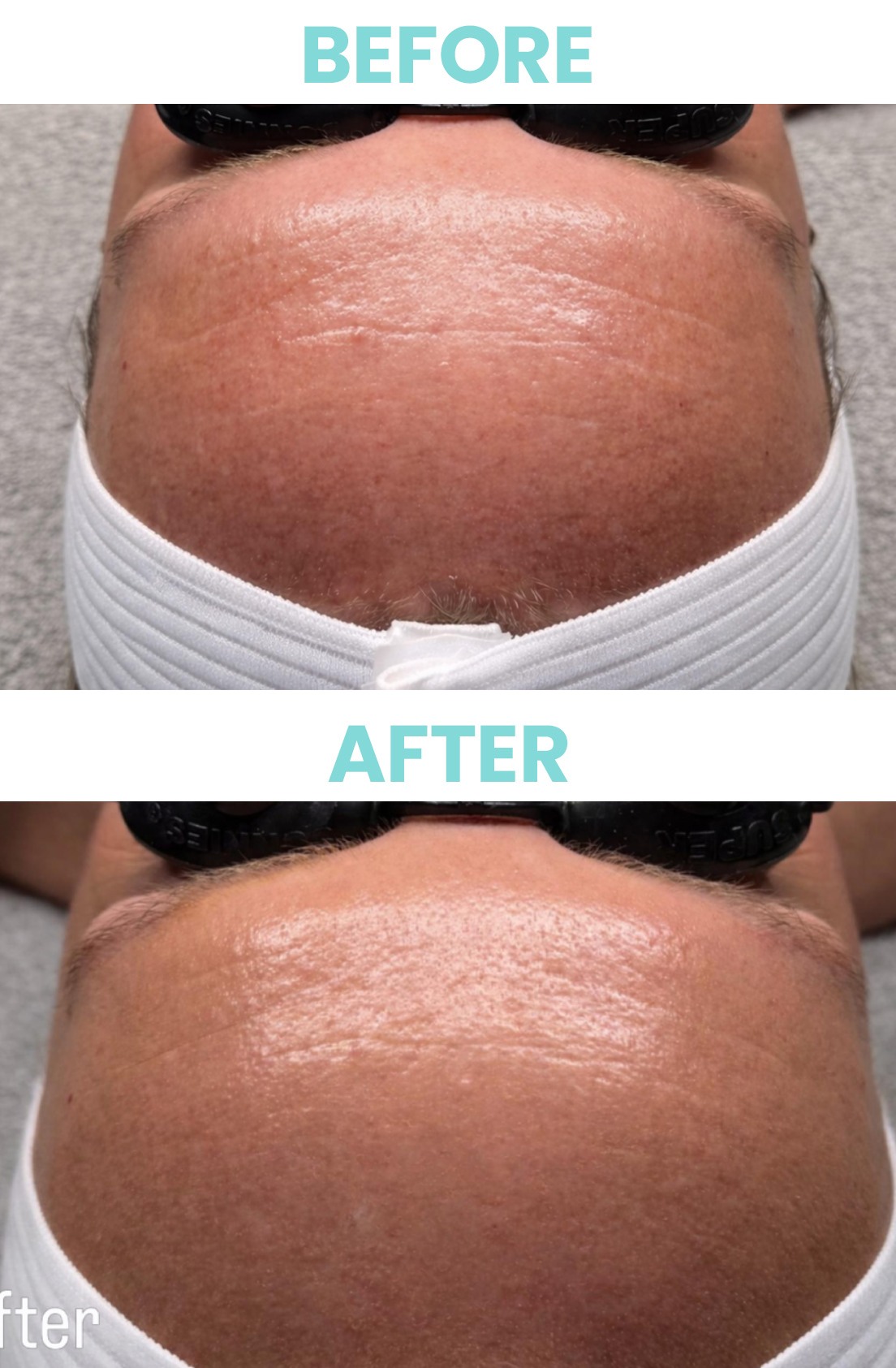 Ageless Signature Spa Facial