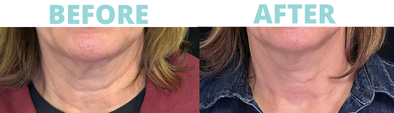 Skinvive