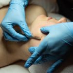 Dermaplaning