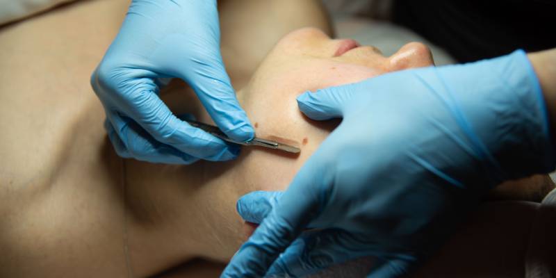 Dermaplaning, Kernersville, NC